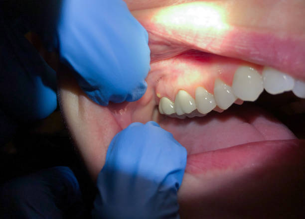 Best Dentist Open Late Near Me  in Anahuac, TX